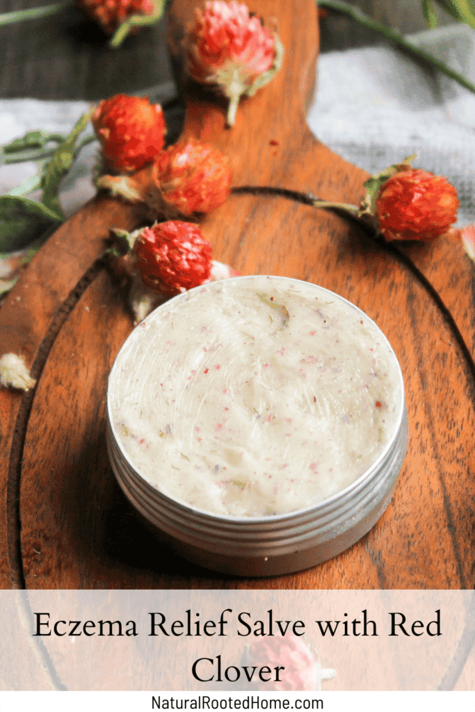 eczema relief salve